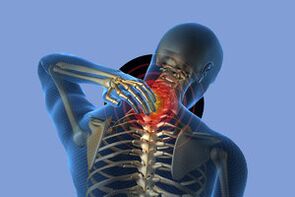 Mga sintomas ng cervical osteochondrosis