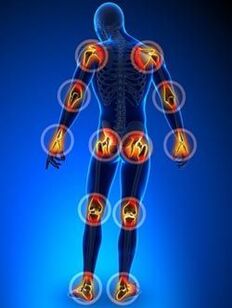 Ang lokalisasyon ng mga kasukasuan na apektado ng arthrosis