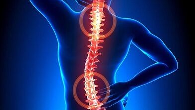 mekanismo ng pag-unlad ng osteochondrosis