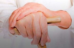 sakit sa mga kasukasuan ng mga daliri na may rheumatoid arthritis