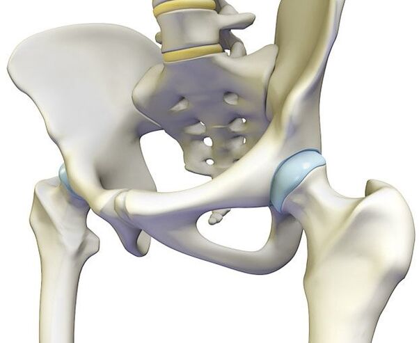 Ang Osteochondrosis ay naghihikayat ng matinding sakit sa hip joint