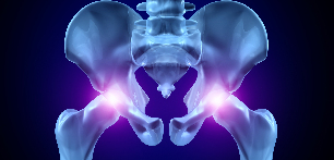 osteoarthritis ng hip joint